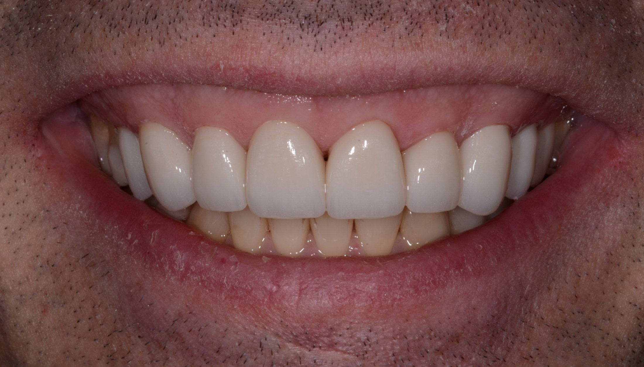 Michael J. Perona, DDS | Digital Radiography, Preventative Program and Dental Cleanings