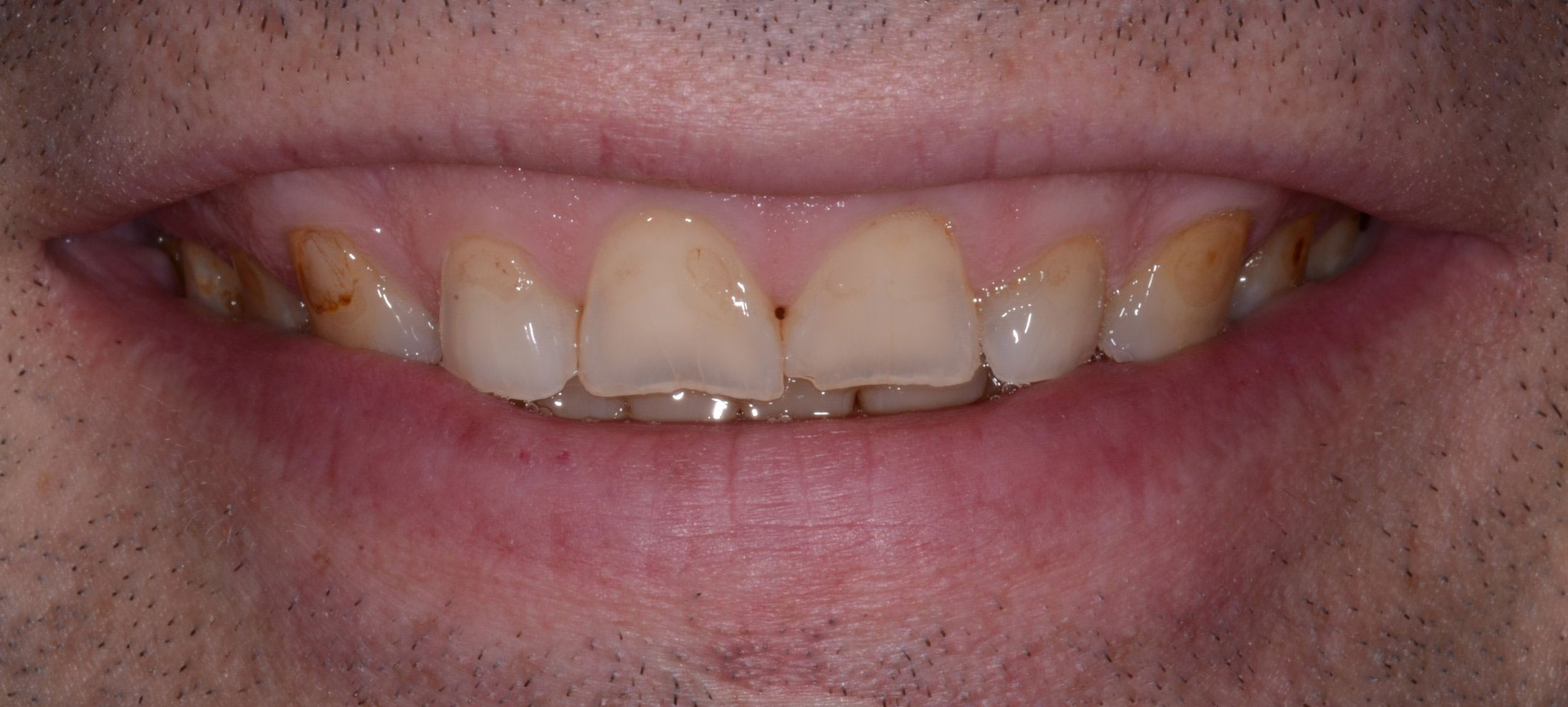 Michael J. Perona, DDS | CEREC, Dental Cleanings and TMJ Disorders