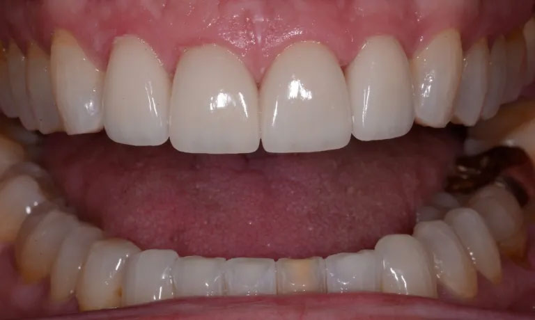 Michael J. Perona, DDS | Laser Dentistry, TMJ Disorders and Ceramic Crowns