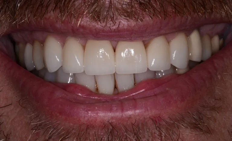 Michael J. Perona, DDS | Veneers, CEREC and Dental Bridges