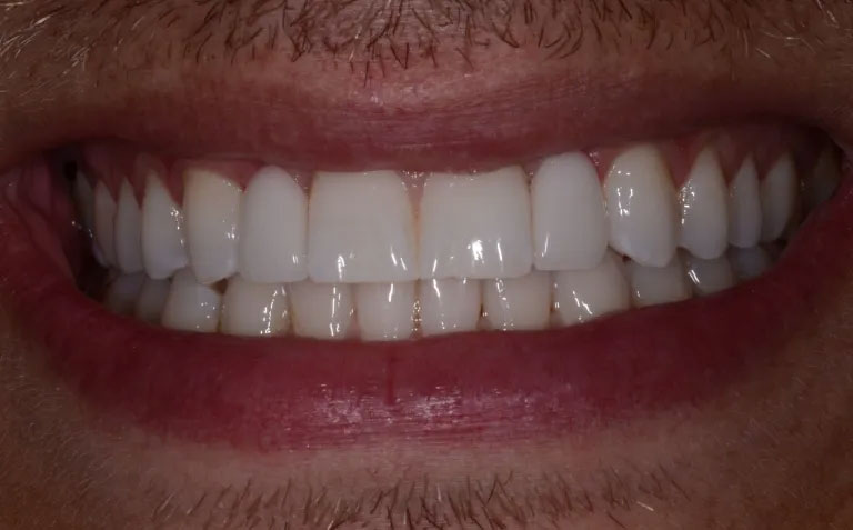 Michael J. Perona, DDS | Periodontal Treatment, Emergency Treatment and Dental Fillings