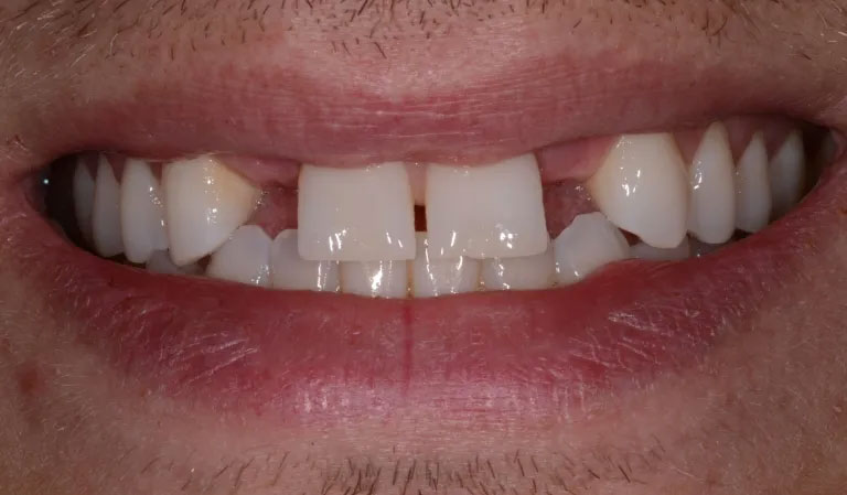 Michael J. Perona, DDS | Invisalign reg , Dental Fillings and Oral Exams