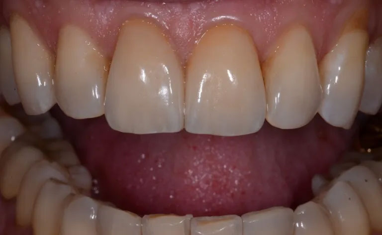 Michael J. Perona, DDS | Digital Impressions, Air Abrasion and Emergency Treatment