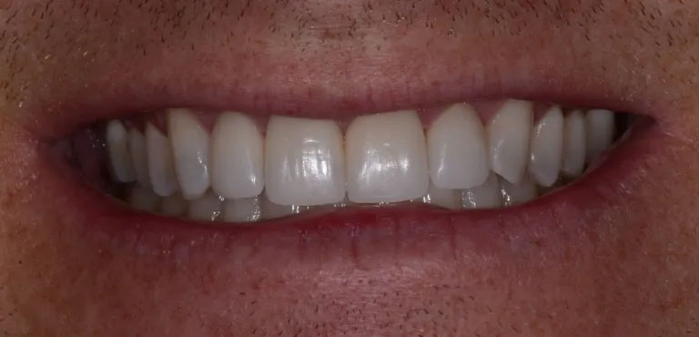 Michael J. Perona, DDS | Implant Restorations, Oral Exams and Cosmetic Dentistry