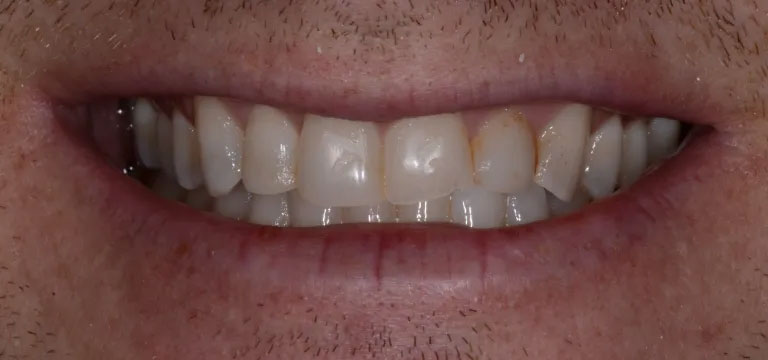 Michael J. Perona, DDS | Invisalign reg , Oral Cancer Screening and Dental Cleanings