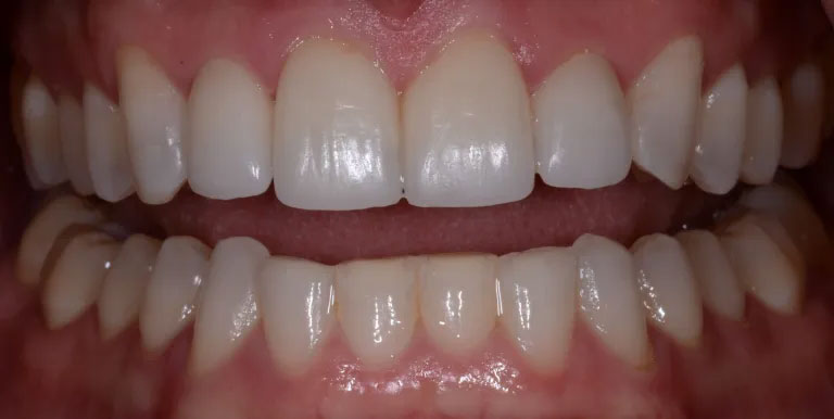 Michael J. Perona, DDS | Oral Exams, Intraoral Camera and Snoring Appliances