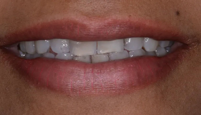 Michael J. Perona, DDS | TMJ Disorders, Sports Mouthguards and Crowns