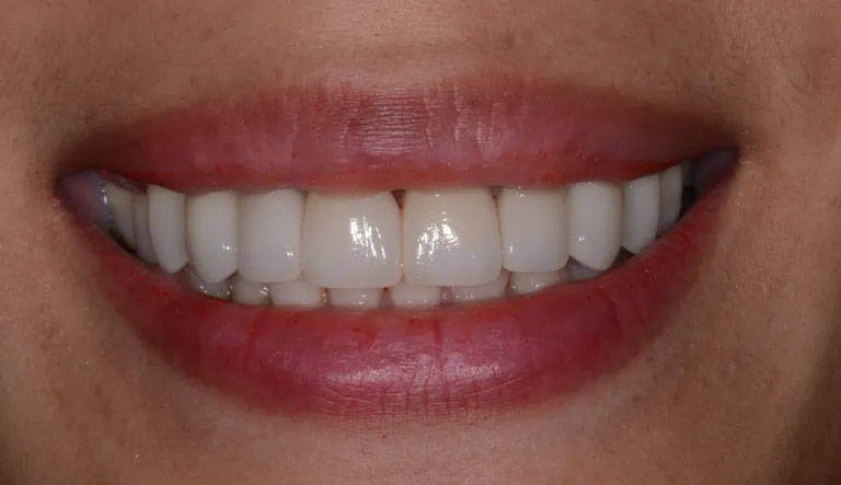 Michael J. Perona, DDS | Emergency Treatment, CEREC and Digital Impressions