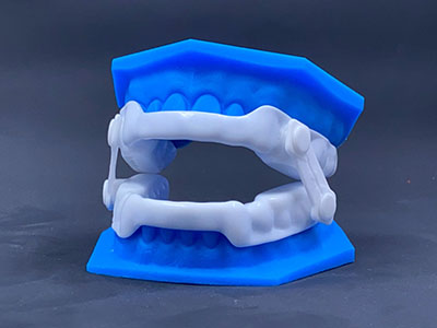 Michael J. Perona, DDS | ZMachine Synergy HST, Sleep Apnea and Digital Impressions