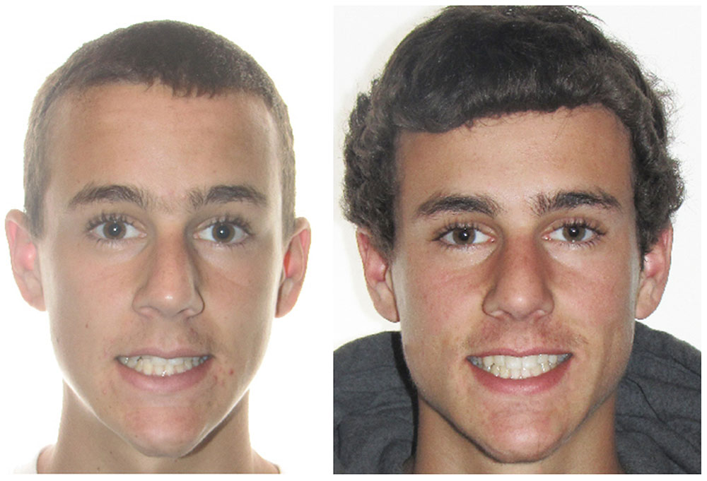 Michael J. Perona, DDS