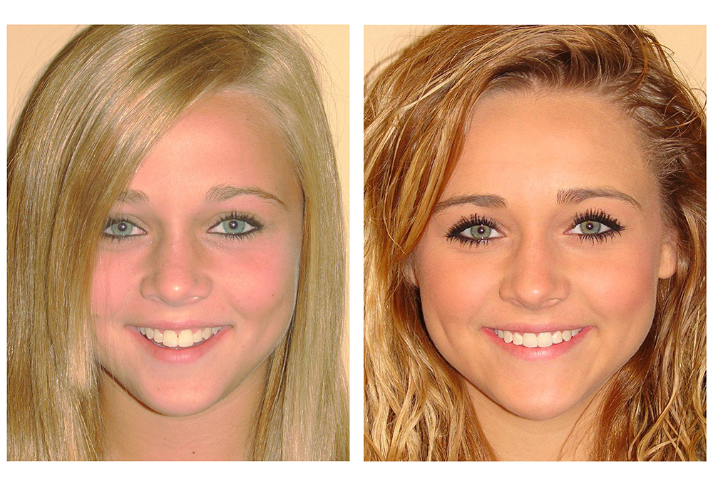 Michael J. Perona, DDS