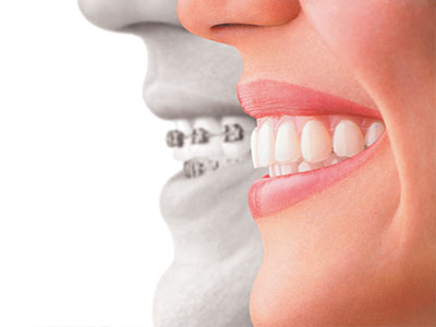 Michael J. Perona, DDS | Oral Exams, Intraoral Camera and Implant Restorations