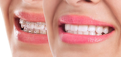 Michael J. Perona, DDS | Cosmetic Dentistry, Emergency Treatment and Dental Fillings
