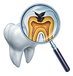 Michael J. Perona, DDS | All-on-4 reg , Oral Cancer Screening and Preventative Program