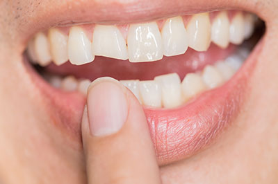 Michael J. Perona, DDS | CEREC, Preventative Program and Oral Exams