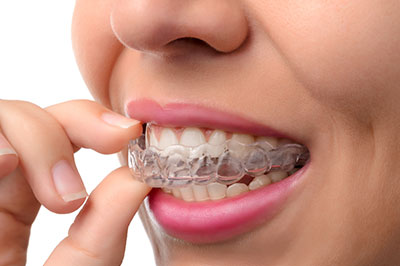 Michael J. Perona, DDS | Dental Bridges, Snoring Appliances and Sleep Apnea