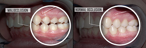 Michael J. Perona, DDS | Crowns, Laser Dentistry and CEREC