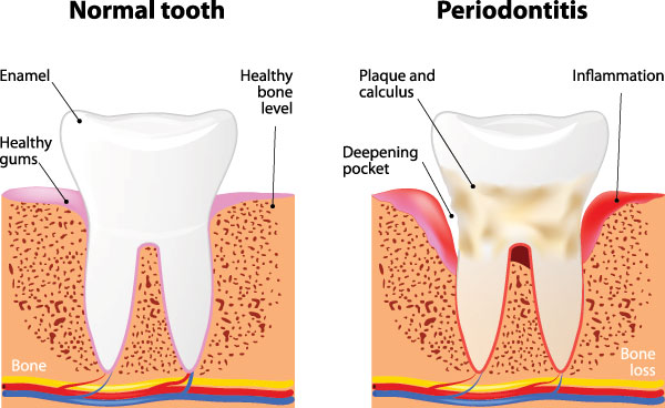 Michael J. Perona, DDS | Teeth Whitening, Sleep Apnea and Dental Bridges