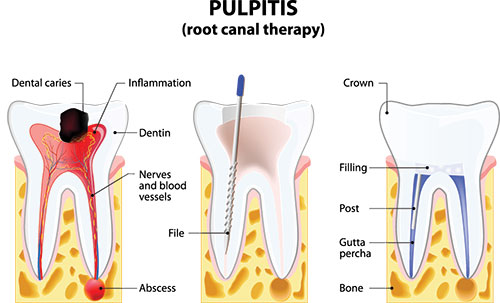 Michael J. Perona, DDS | Digital Impressions, Night Guards and Oral Exams
