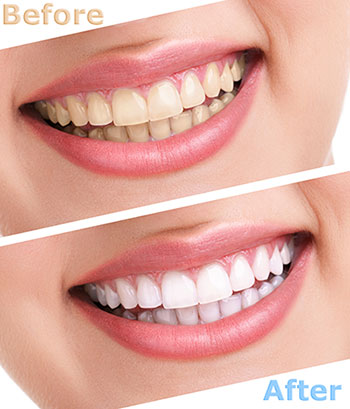 Michael J. Perona, DDS | Dental Cleanings, Periodontal Treatment and Digital Radiography
