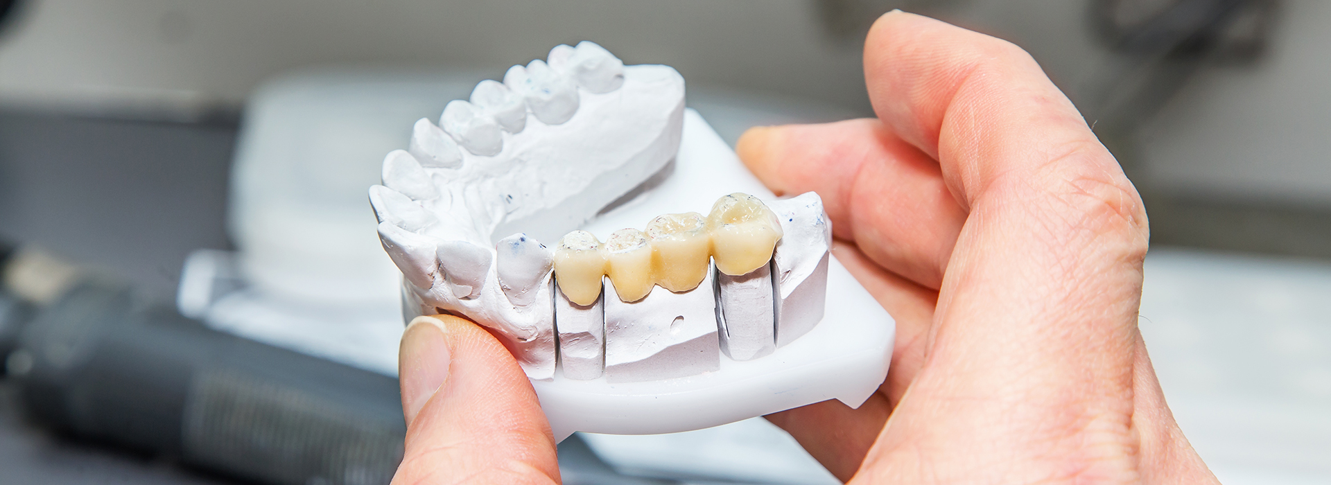 Michael J. Perona, DDS | CEREC, All-on-4 reg and Night Guards