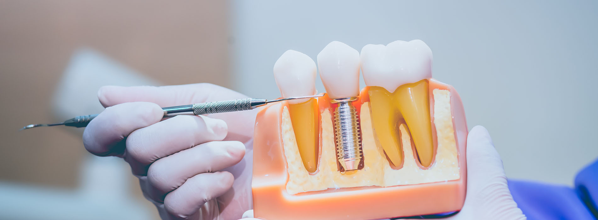 Michael J. Perona, DDS | CEREC, Sleep Apnea and All-on-4 reg