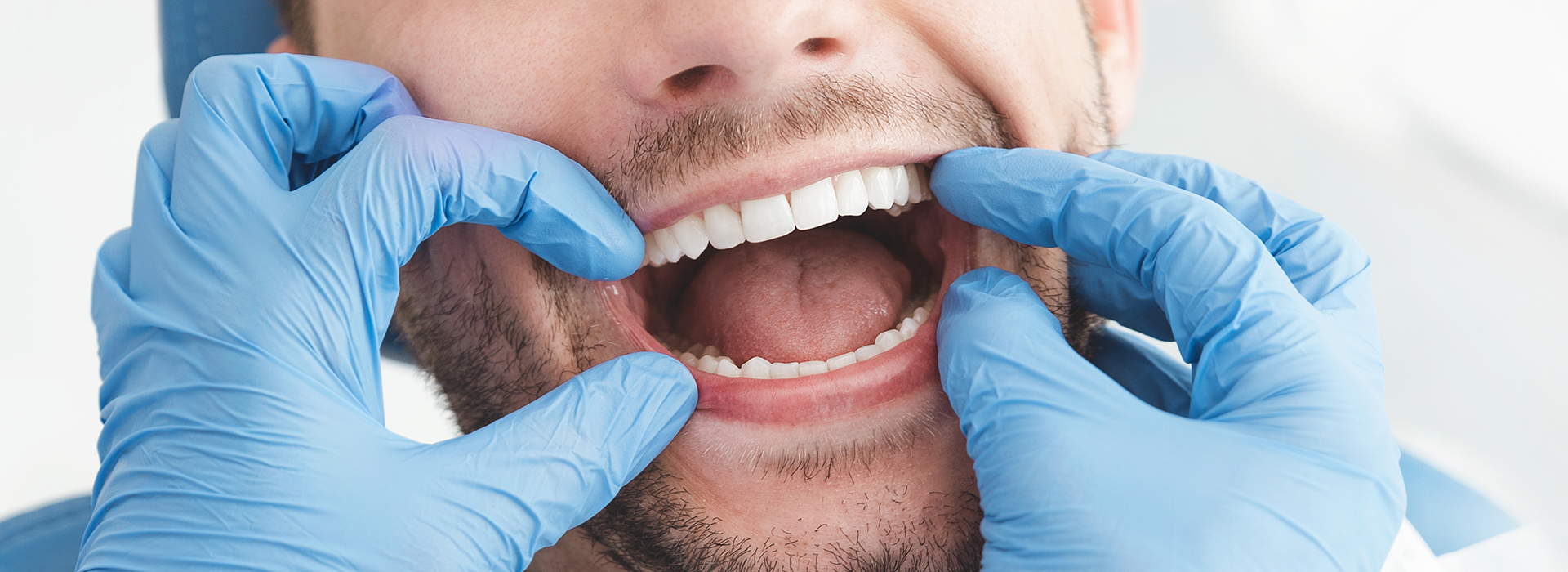 Michael J. Perona, DDS | Fluoride Treatment, Veneers and Sleep Apnea