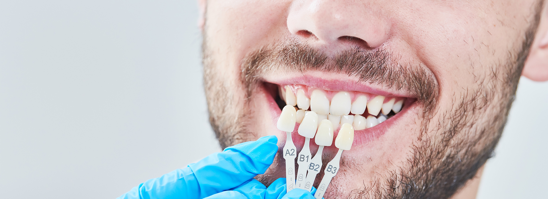 Michael J. Perona, DDS | Air Abrasion, Invisalign reg and Implant Restorations