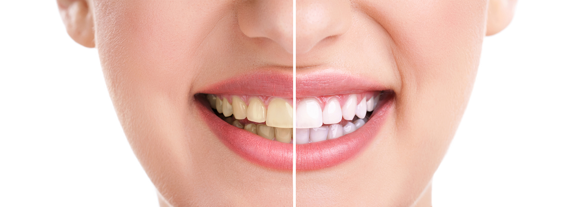 Michael J. Perona, DDS | Periodontal Treatment, All-on-4 reg and Digital Impressions