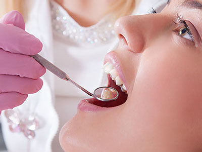 Michael J. Perona, DDS | Dental Fillings, Sleep Apnea and Dental Cleanings
