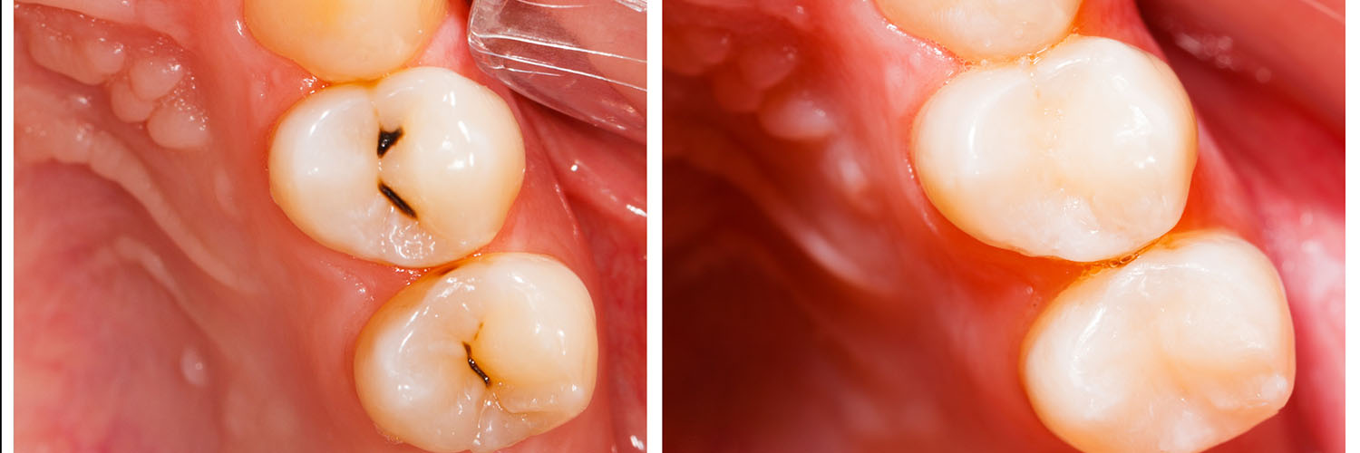 Michael J. Perona, DDS