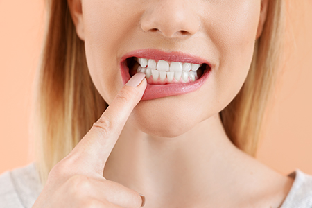 Michael J. Perona, DDS